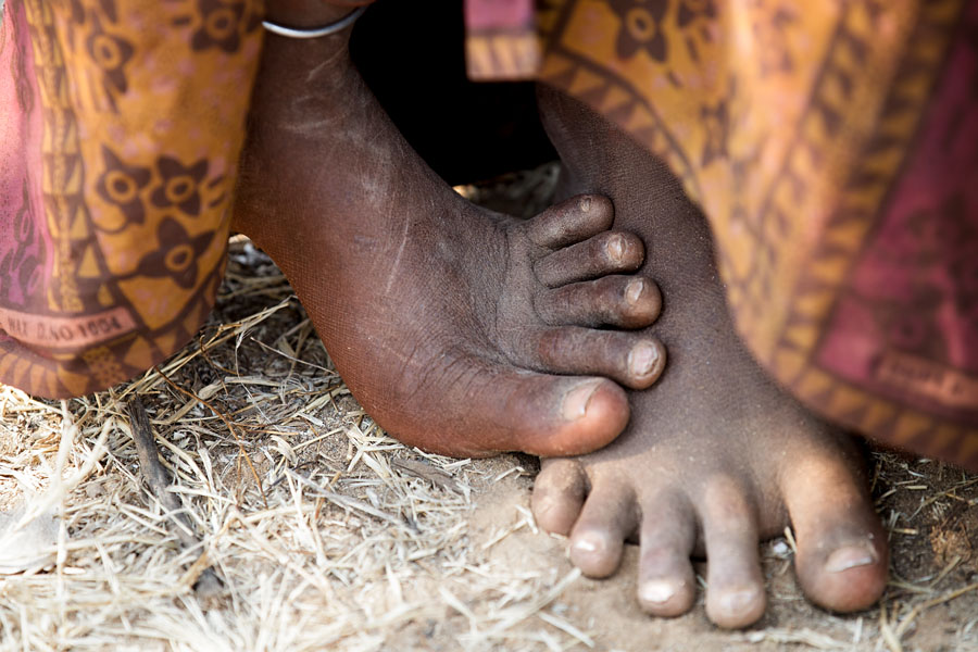  Little Muchimba feet (or Himba tribe)   Angola